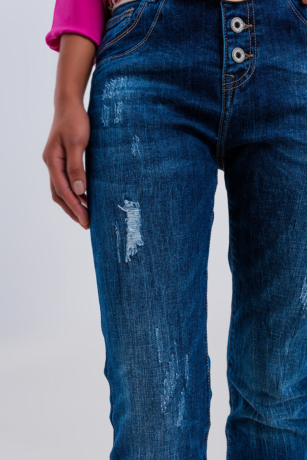 Exposed button ripped boyfriend jean in dark blue - Denim